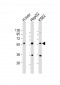 NAGS Antibody (Center)